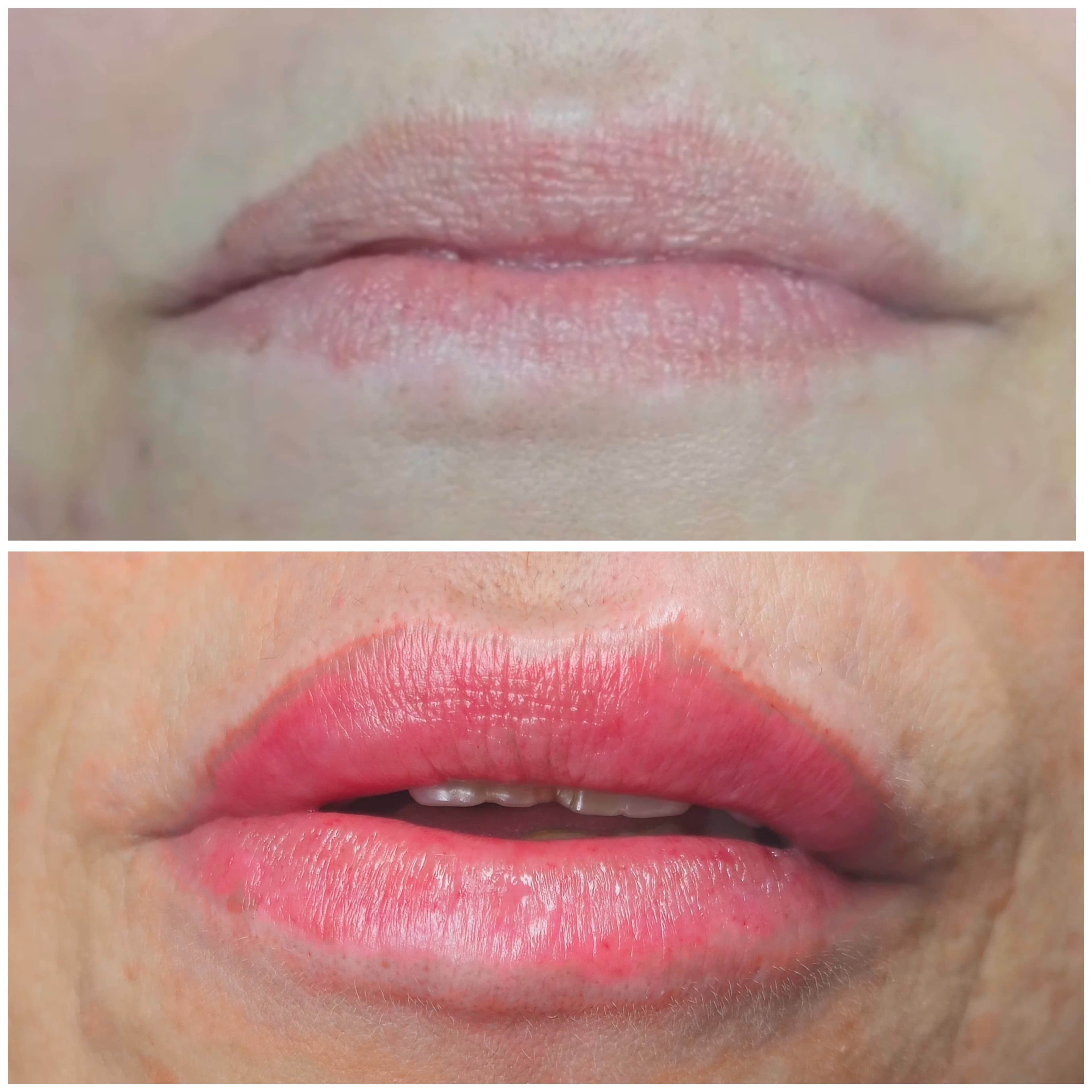 Avant et après d'un maquillage permanent des lèvres rose avec un contour net et défini.